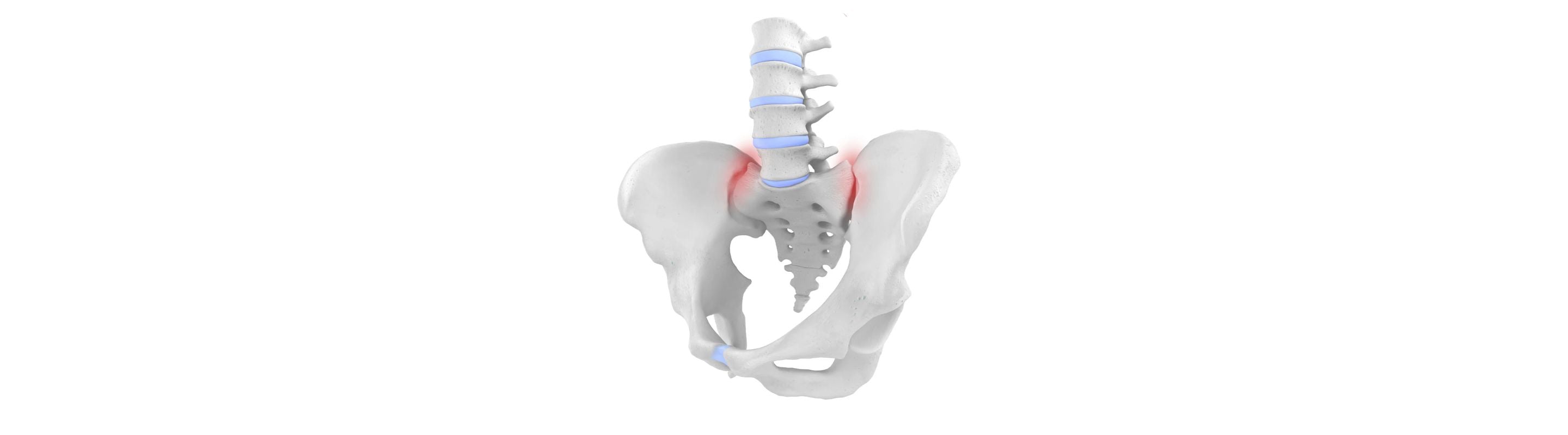 Sacroiliac Joint Dysfunction