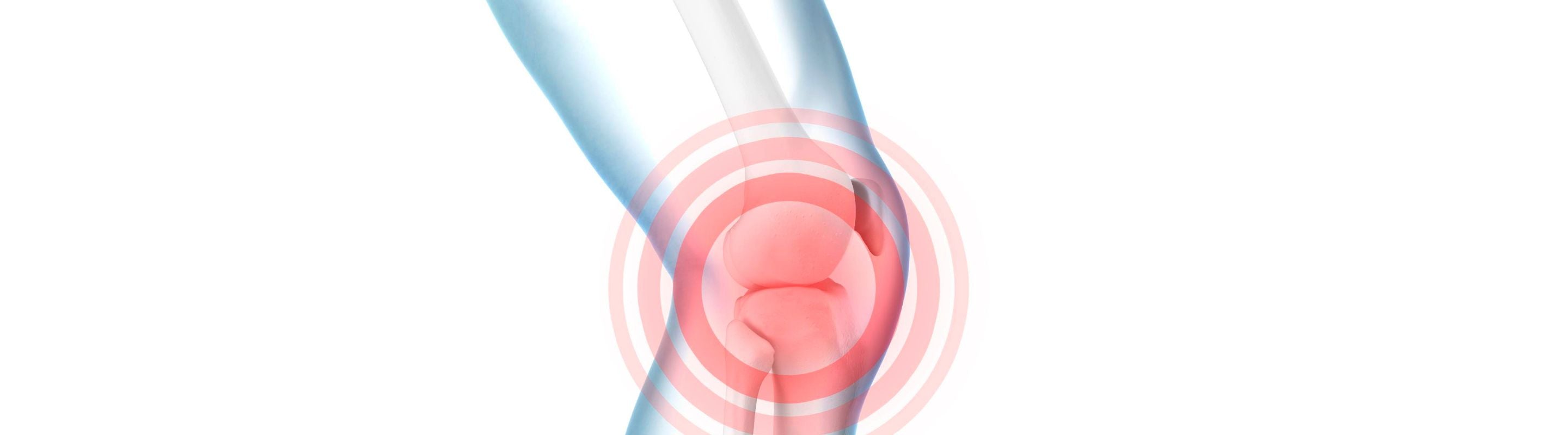 illustration of the skeletal knee with red circles radiating from the joint, indicating pain