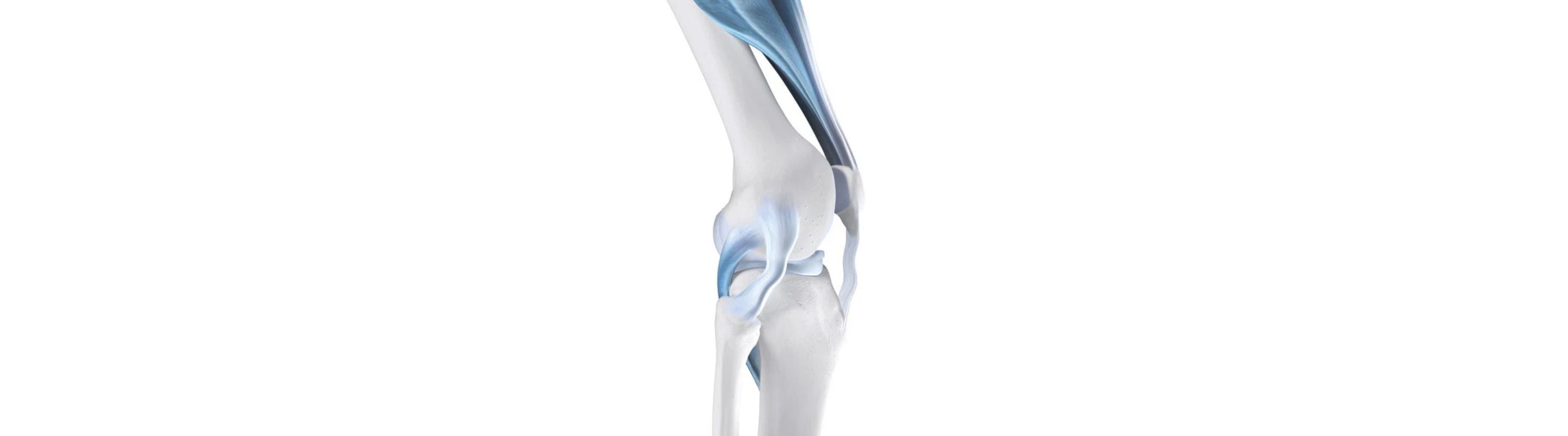 Illustration of the skeletal knee with ligaments and tendons, which factor into knee stability