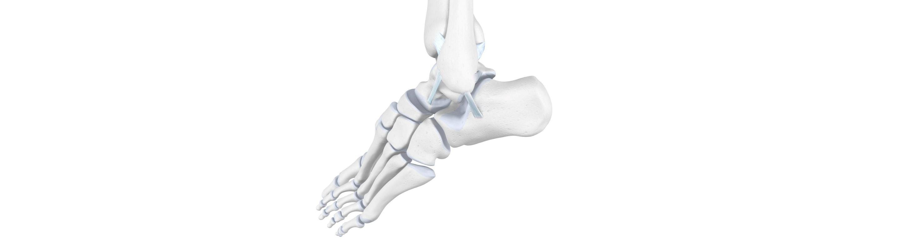 illustration of the skeletal ankle. It is bent awkwardly to the side and the ligaments look stretched, indicating overextension or ligament sprain.