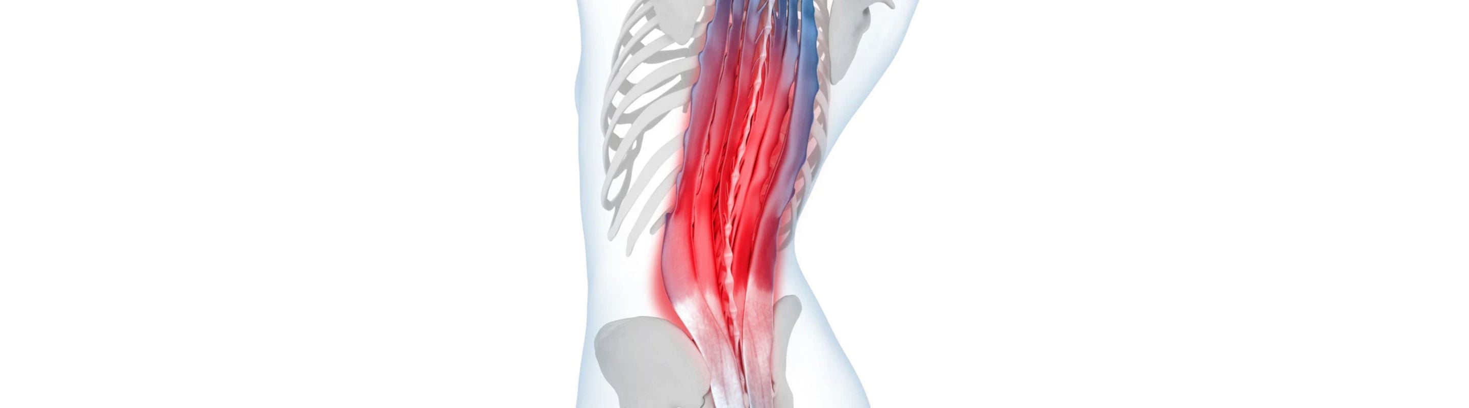 illustration of the back, see-through so that it shows the muscles and bones. The muscles along the spine are coloured bright red, indicating back pain and tension