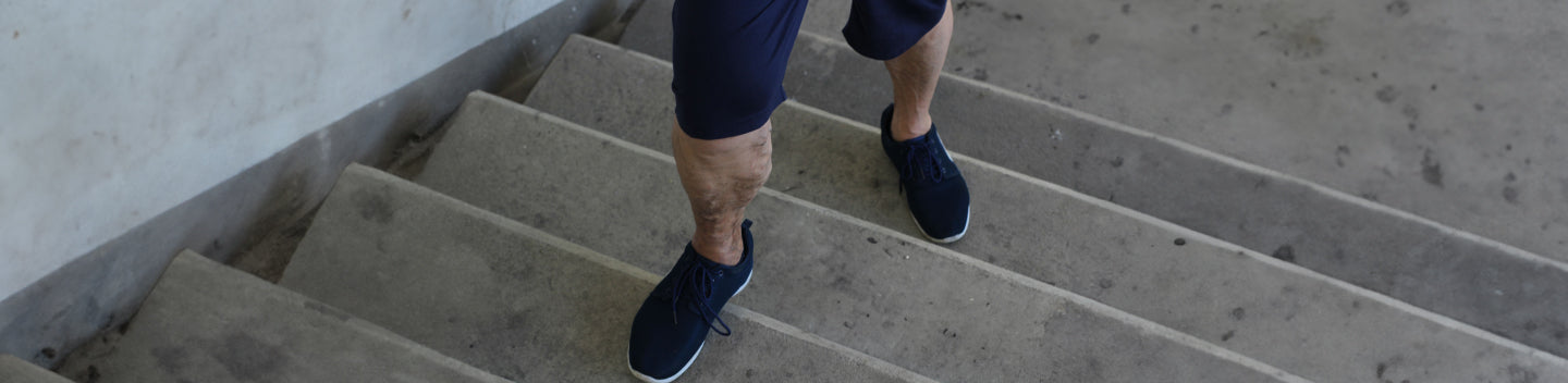 person with varicose veins climbing the stairs in sports gear.