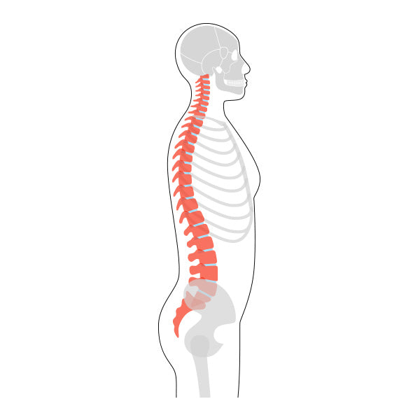 Hyperkyphosis & Dowager’s Hump - Causes, Symptoms, & Treatment– Bauerf