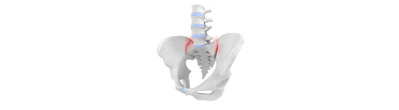 Sacroiliac Joint Dysfunction