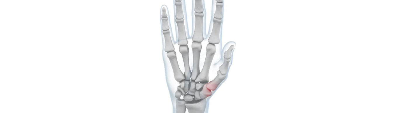 illustration of the hand with see through skin. You can see a red area over the thumb joint, indicating pain.