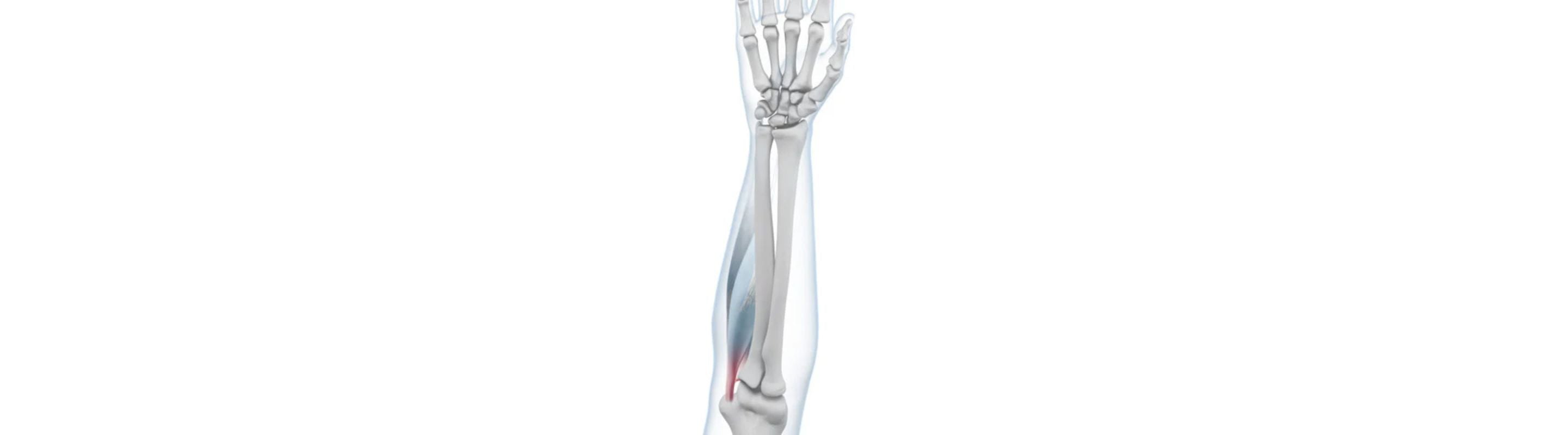 Golfers Elbow & Arm