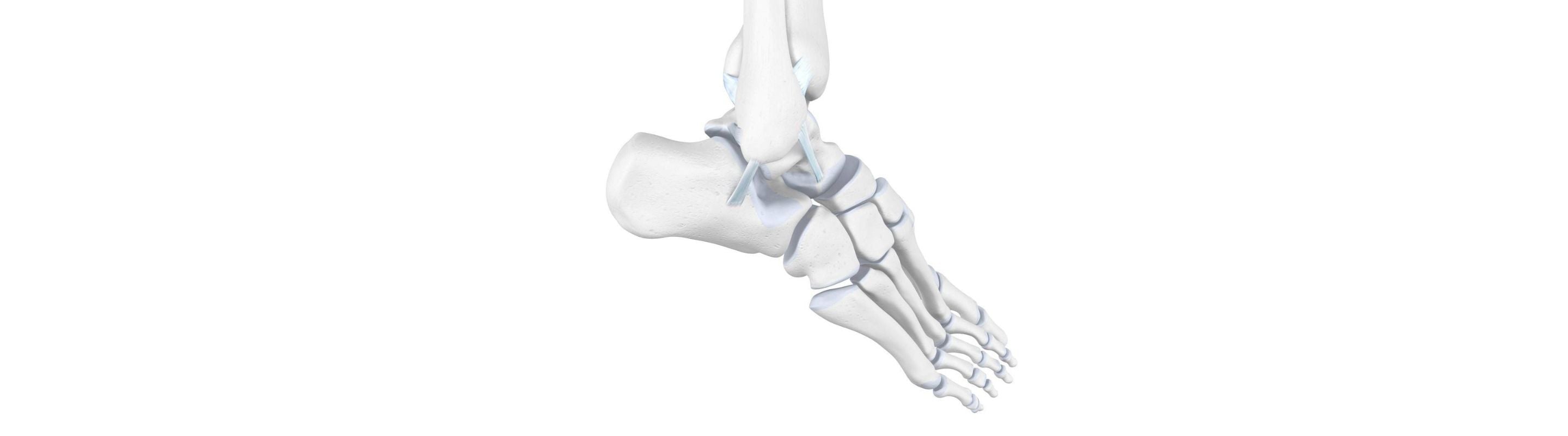 illustration of the skeletal foot and ankle. It shows some signs of ankle distortion