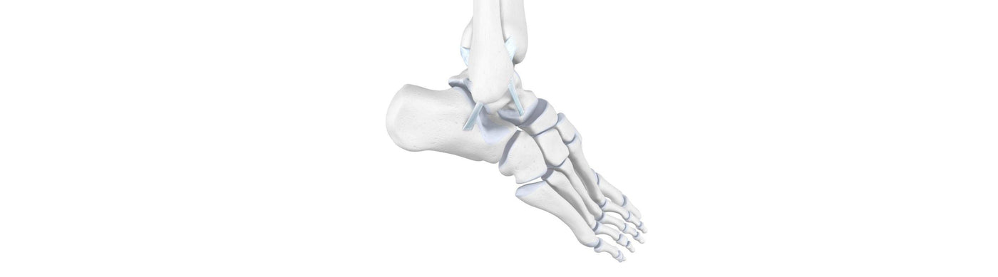illustration of the skeletal foot and ankle. It shows some signs of ankle distortion