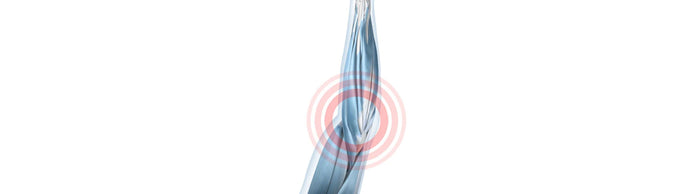 Illustration of the arm with see-through skin so you can see the underlying soft tissues. There is a rec circle around the elbow, indicating tendon attachment irritation.