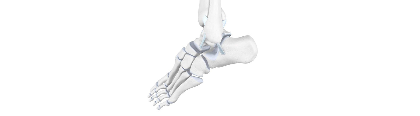 illustration of the skeletal ankle. It is bent awkwardly to the side and the ligaments look stretched, indicating overextension or ligament sprain.