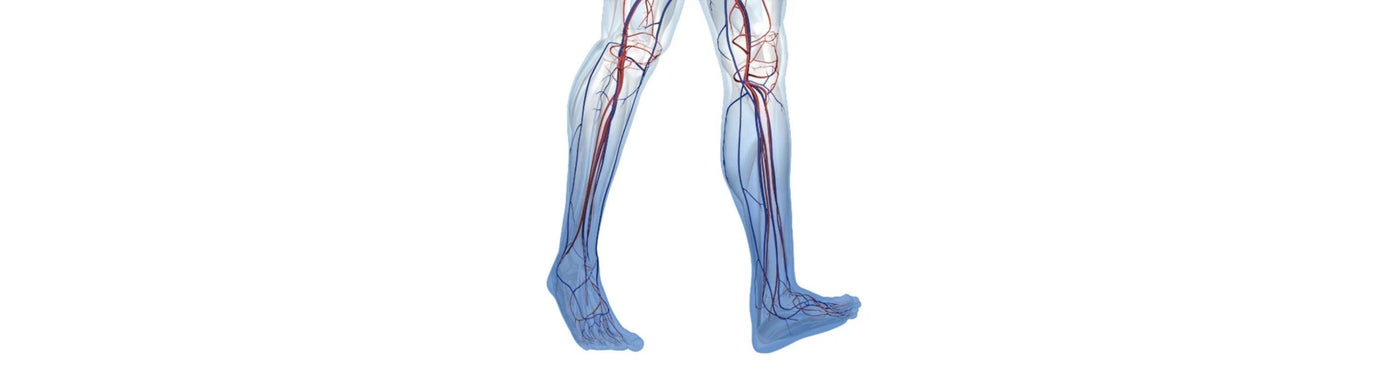 illustration of the lower legs. The feet and lower calves are blue, indicating circulation problems from chronic venous insufficiency 