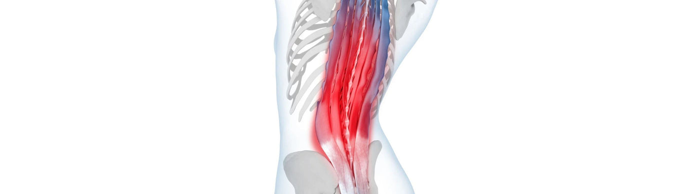 illustration of the back, see-through so that it shows the muscles and bones. The muscles along the spine are coloured bright red, indicating back pain and tension