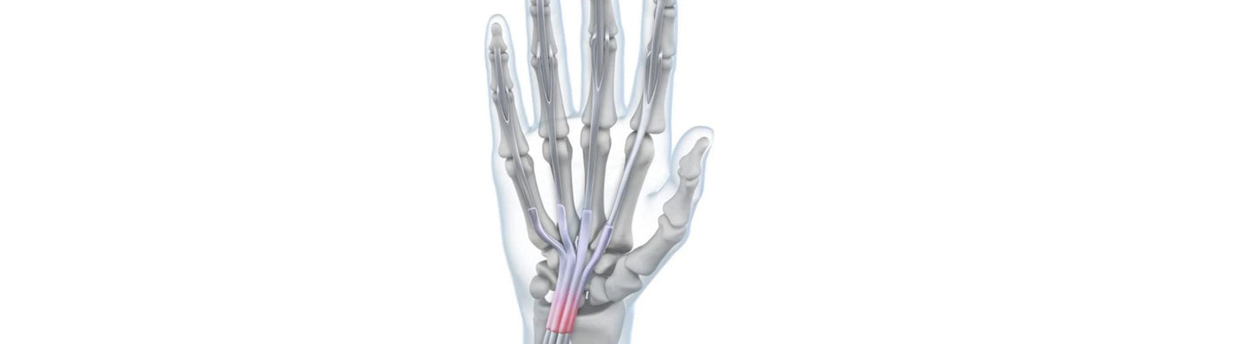 illustration of the hand with see-through skin. There is redness over the wrist tendons, indicating wrist tendonitis pain.