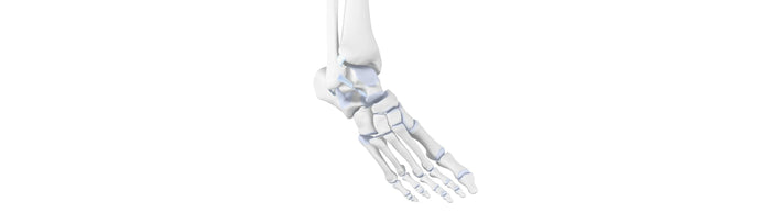 illustration of the skeletal ankle depicting supination trauma