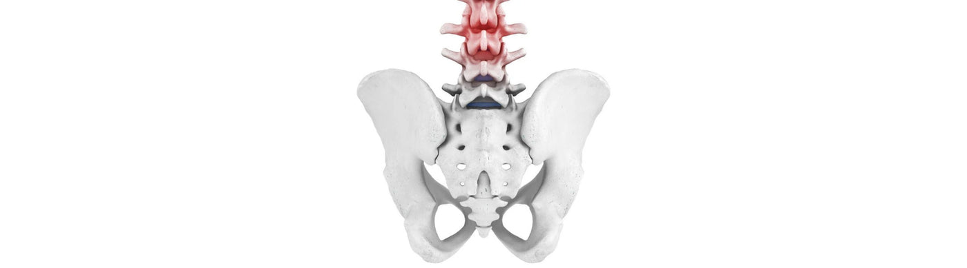 Lumbago - Lumbar Spine Syndrome